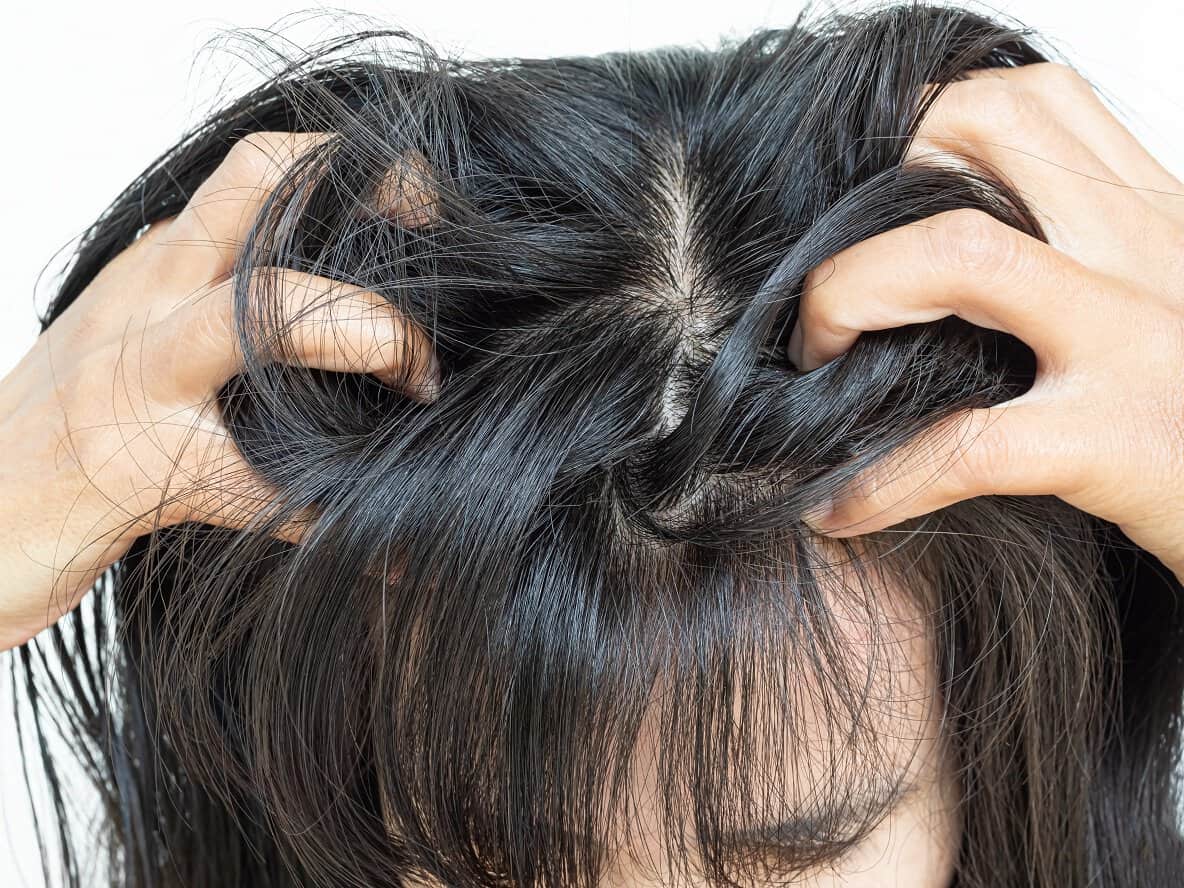 Sensitive scalp persona